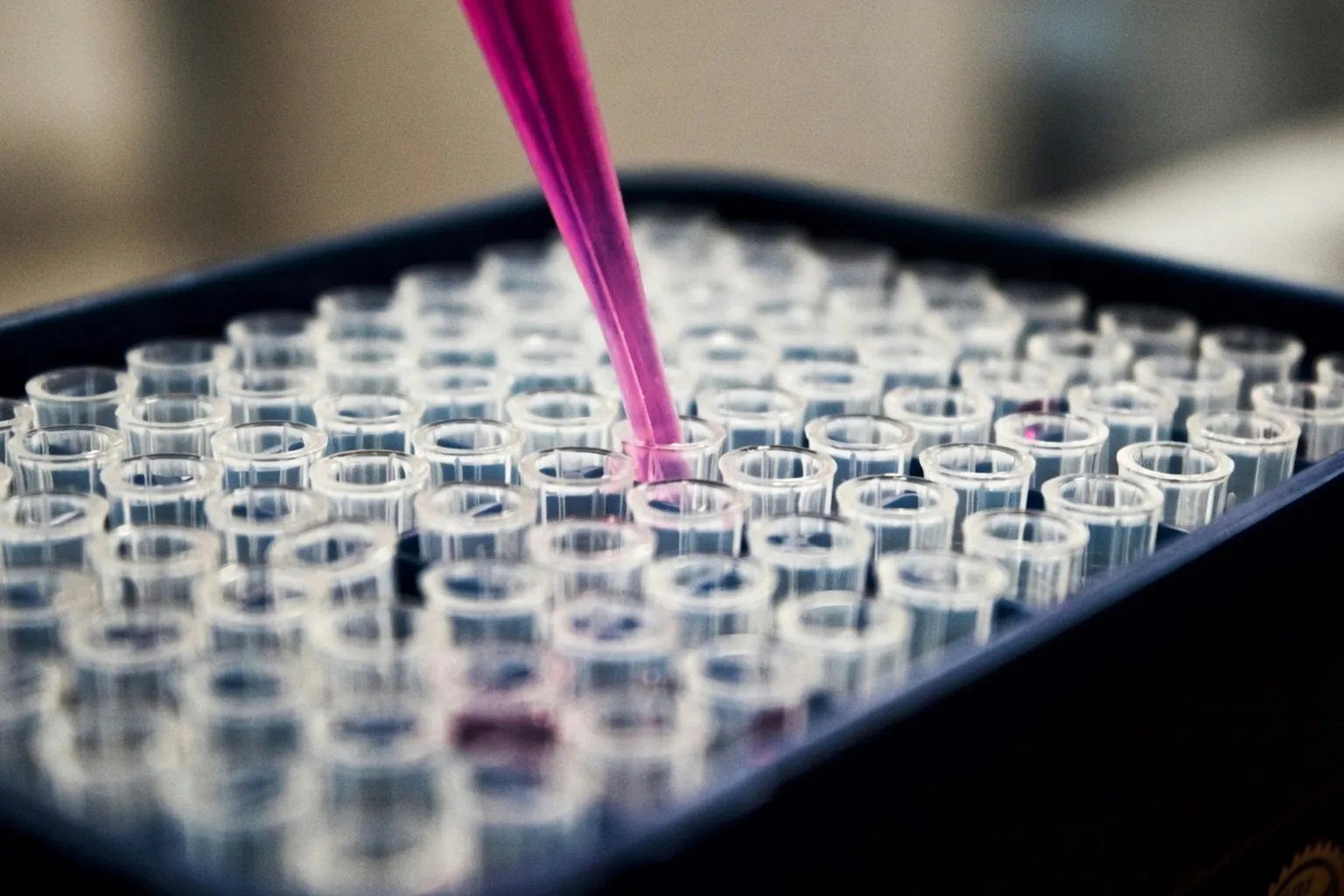 Pourquoi la psychiatrie devrait s'inspirer des tests biologiques utilisés en oncologie